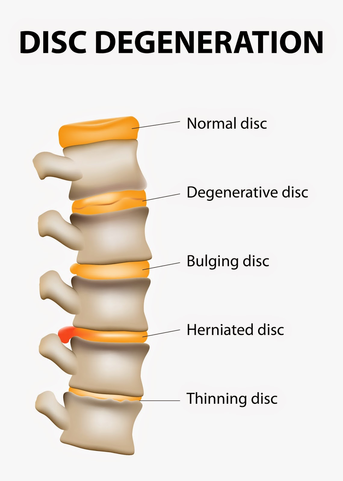 how many discs in spine